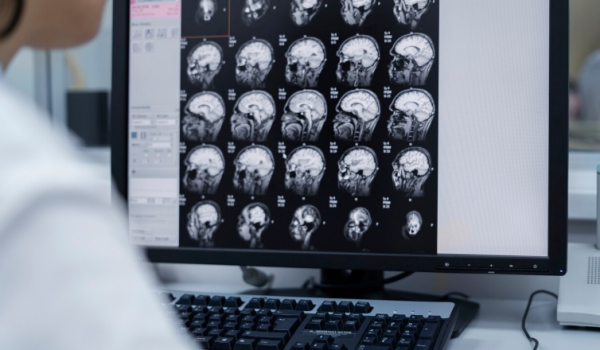 Электроэнцефалография